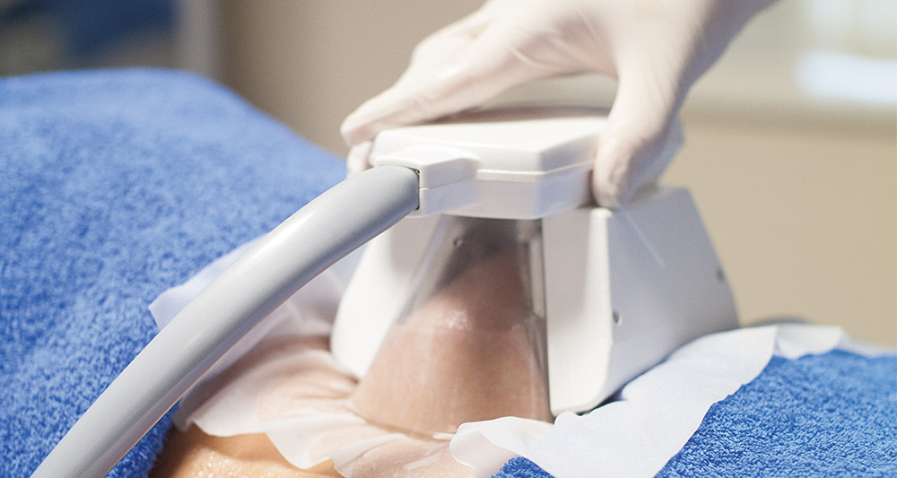 How Fat Freezing and HIFU Work Together? 2 Multiple Areas in One Session HIFU and Fat Freezing Warwick